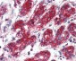 MNSOD / SOD2 Antibody